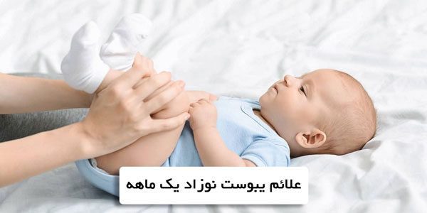نوزادی دراز کشیده که پاهایش را مادرش در دست گرفته