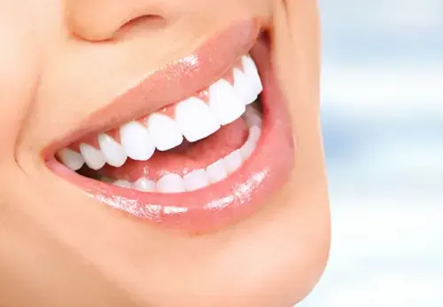 چگونه دندان هایمان را سفید کنیم؟ ( انواع روش های سفید کردن دندان )