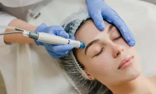 ار اف چیست و مناسب چه کسانی است؟ ( مزایا + عوارض rf پوست )