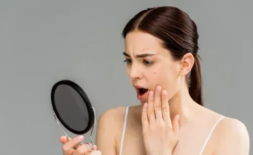 علت جوش صورت در نقاط مختلف ( علت جوش پیشانی – چانه – روی بینی و… )
