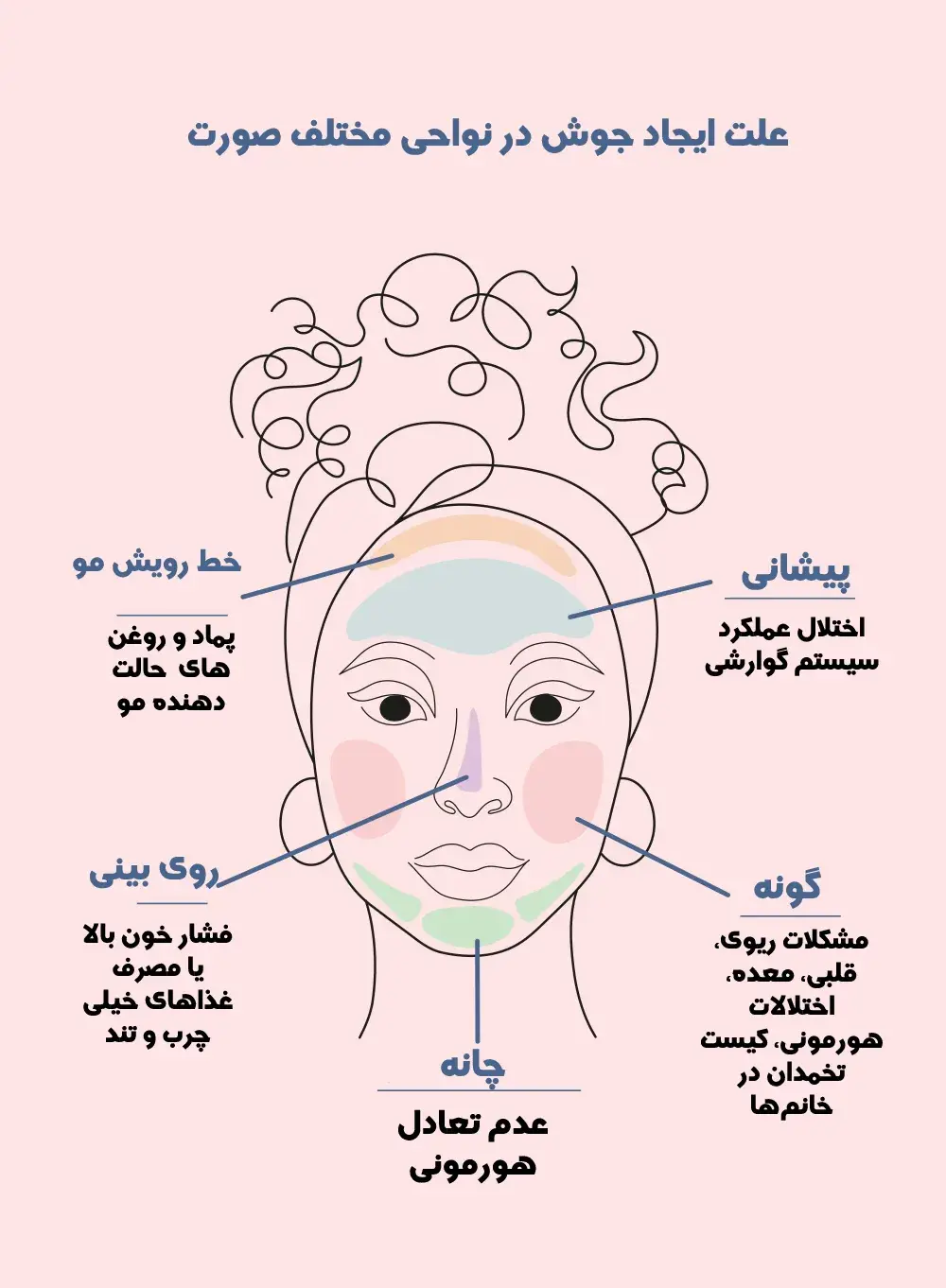 اینفوگرافی علت ایجاد جوش در نواحی محتلف صورت