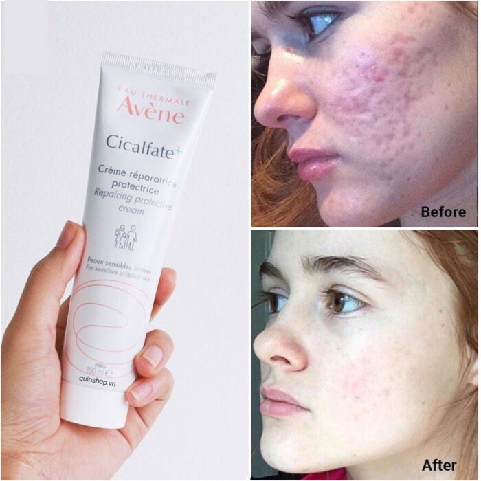 کرم ترمیم کننده اون سیکالفیت پلاس AVENE CICALFATE PLUS حجم 40 میل