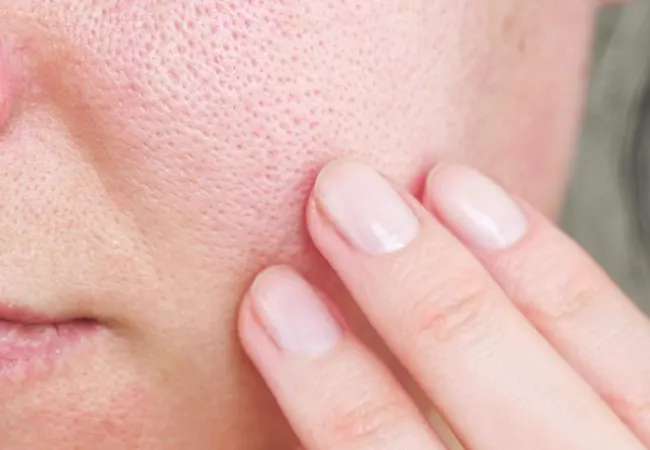 ماسک برای منافذ باز پوست ( معرفی بهترین مارک ماسک شرکتی + خانگی )
