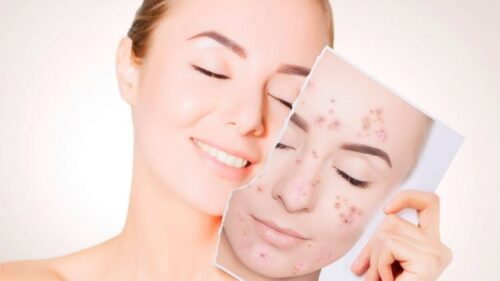 سرم تسکین دهنده و یکدست کننده پوست آلوئه ورا 2% و ناگ 2% اوردینری