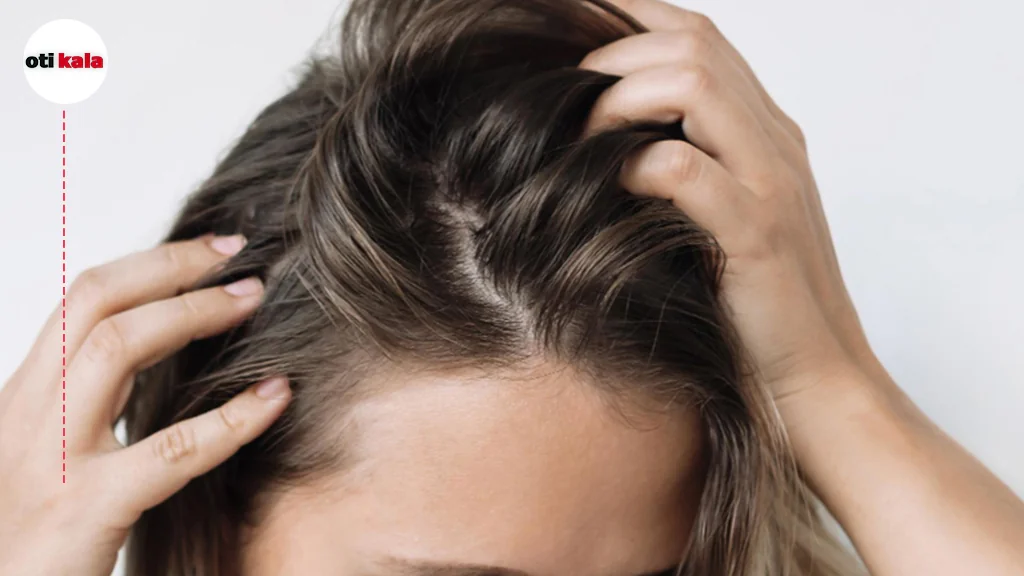 برای موهای چرب از چه سرمی استفاده کنیم؟