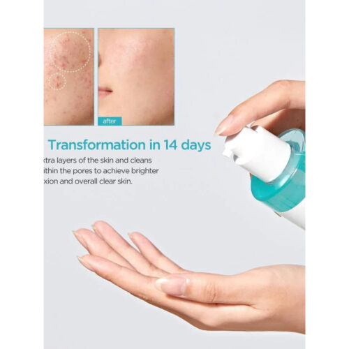 تونر لایه بردار و کنترل منافذ آنوا Anua BHA 2% Gentle Exfoliating Toner