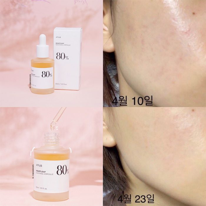 آمپول تسکین دهنده و مرطوب‌کننده آنوا حاوی عصاره هوتونیا کوردتا (Anua Heartleaf 80% Moisture Soothing Ampoule 30ml)