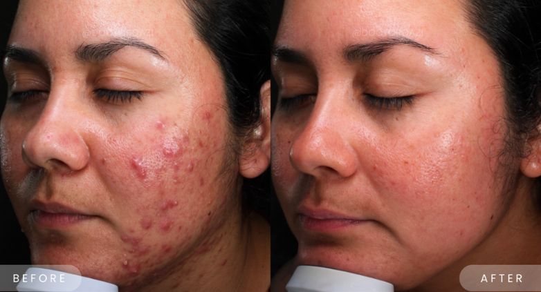چگونه محصولات کوزارکس پوست شما را متحول میکنند؟ 18 چگونه محصولات کوزارکس پوست شما را متحول میکنند؟