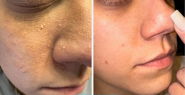 چگونه محصولات کوزارکس پوست شما را متحول میکنند؟ 20 چگونه محصولات کوزارکس پوست شما را متحول میکنند؟